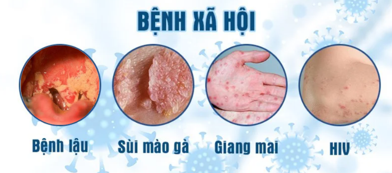 bệnh xã hội